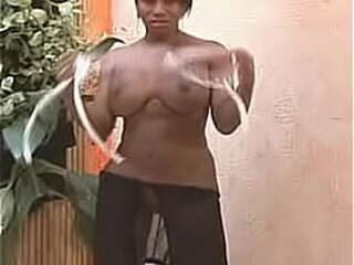 michael jacksons vitiligo on penis ladyboy